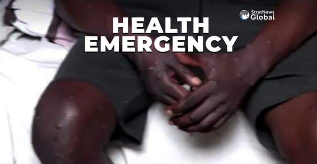 mpox spread leads to public hearlth emergency in Africa